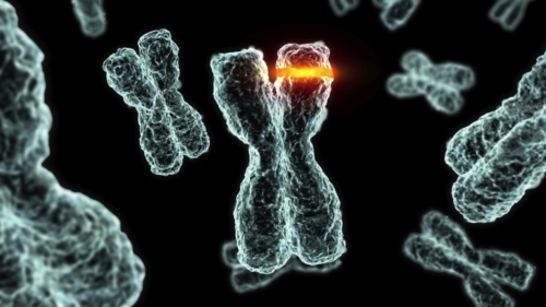 Cholesterol Vs Homocysteine: Who is actually guilty?
